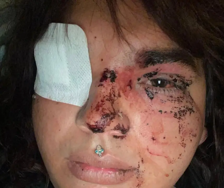 Imagen de la v&iacute;ctima de la agresi&oacute;n de La Ba&ntilde;eza, Bianca Lisbeth Fern&aacute;ndez, publicada en las redes sociales de @CambrolleMar.