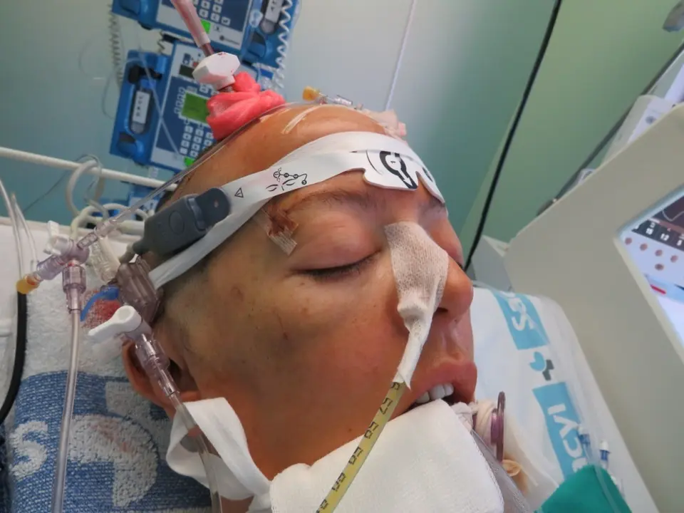 Raquel D&iacute;az fue brutalmente agredida por su entonces marido, el expol&iacute;tico berciano Pedro Mu&ntilde;oz, el 27 de mayo de 2020. Sobrevivi&oacute;.