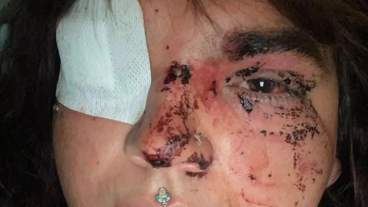 Imagen de la v&iacute;ctima de la agresi&oacute;n de La Ba&ntilde;eza, Bianca Lisbeth Fern&aacute;ndez, publicada en las redes sociales de @CambrolleMar.