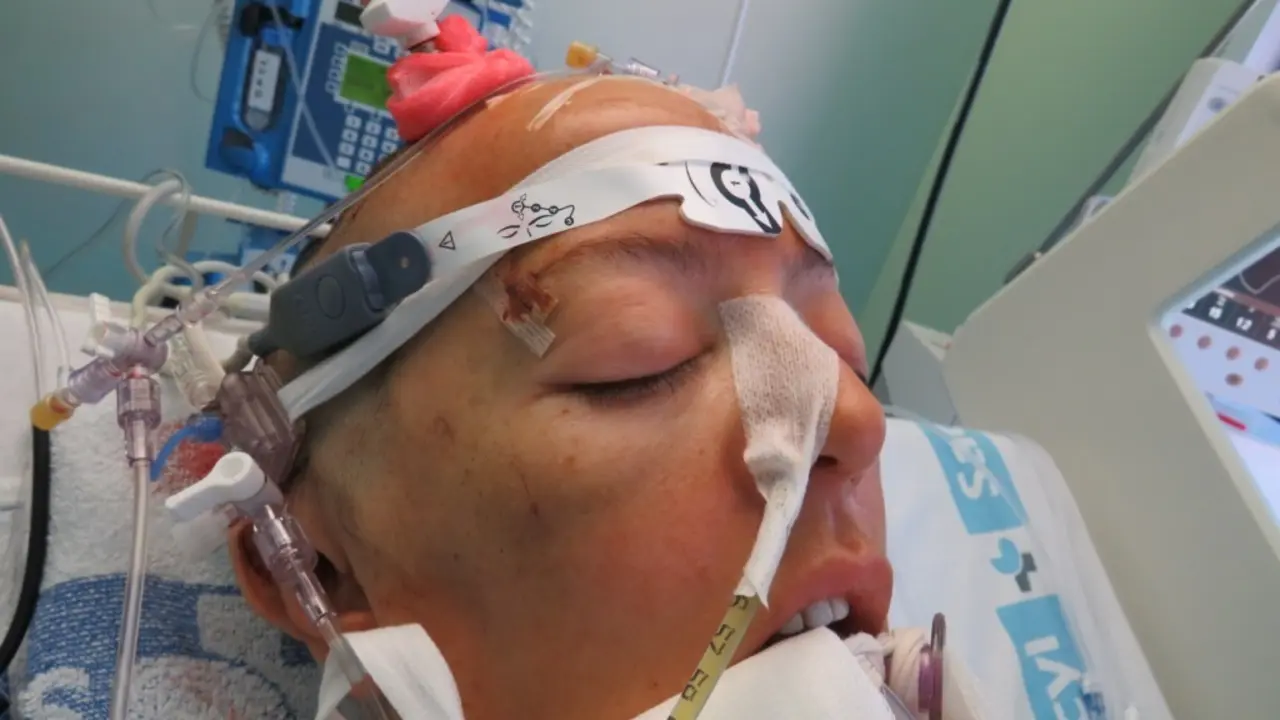 Raquel D&iacute;az fue brutalmente agredida por su entonces marido, el expol&iacute;tico berciano Pedro Mu&ntilde;oz, el 27 de mayo de 2020. Sobrevivi&oacute;.
